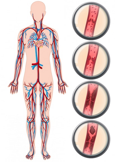 png image of blood flow and its toxin levels